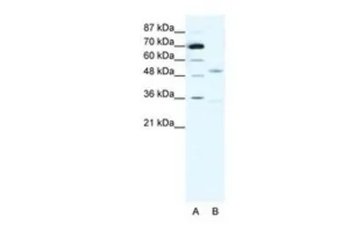 Anti-AChR gamma antibody, N-term used in Western Blot (WB). GTX77689