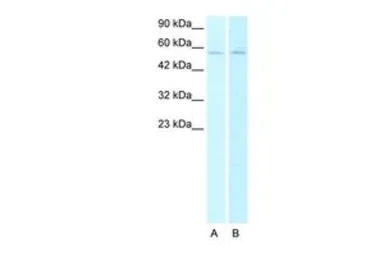 Anti-AChR alpha 2 antibody, N-term used in Western Blot (WB). GTX77709