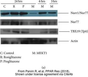 Anti-TBX19 antibody, N-term used in Western Blot (WB). GTX77878