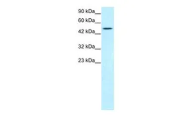 Anti-TBX19 antibody, N-term used in Western Blot (WB). GTX77878