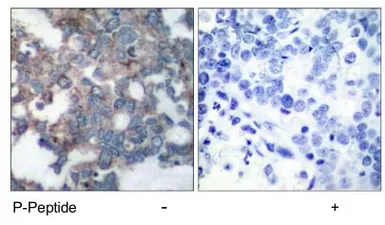 Anti-p70 S6K (phospho Ser424) antibody used in IHC (Paraffin sections) (IHC-P). GTX78978