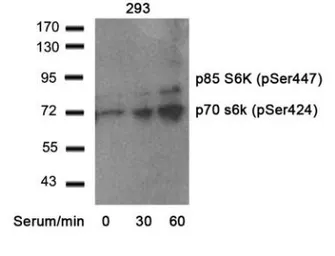 Anti-p70 S6K (phospho Ser424) antibody used in Western Blot (WB). GTX78978