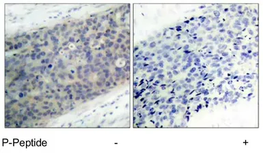 Anti-LIM kinase 2 (phospho Thr505) antibody used in IHC (Paraffin sections) (IHC-P). GTX79022