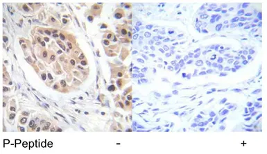 Anti-FOXO3A (phospho Ser253) antibody used in IHC (Paraffin sections) (IHC-P). GTX79072