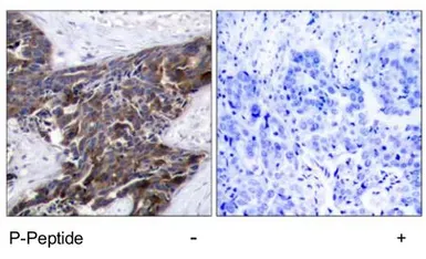 Anti-Connexin 43 (phospho Ser368) antibody used in IHC (Paraffin sections) (IHC-P). GTX79102