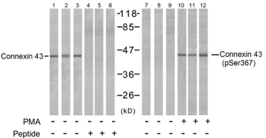 Anti-Connexin 43 (phospho Ser368) antibody used in Western Blot (WB). GTX79102