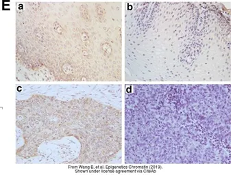 Anti-SSTR5 antibody used in IHC (Paraffin sections) (IHC-P). GTX79168