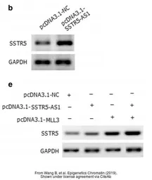 Anti-SSTR5 antibody used in Western Blot (WB). GTX79168