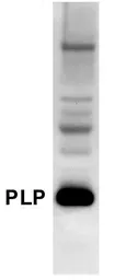 Anti-Myelin PLP antibody used in Western Blot (WB). GTX79243