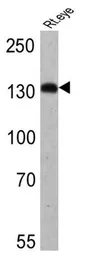 Anti-HCN4 antibody [SHG 1E5] used in Western Blot (WB). GTX79454