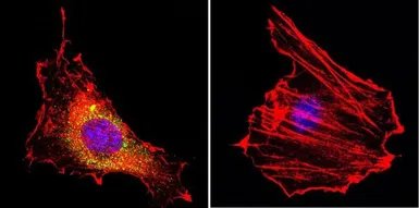 Anti-CNG Channel antibody [CNC 9C1] used in Immunocytochemistry/ Immunofluorescence (ICC/IF). GTX79456