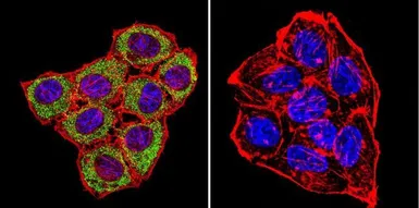 Anti-CNG Channel antibody [CNC 9C1] used in Immunocytochemistry/ Immunofluorescence (ICC/IF). GTX79456