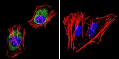 Anti-AKAP9 antibody [17G10] used in Immunocytochemistry/ Immunofluorescence (ICC/IF). GTX79473