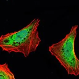 Anti-Ataxin 1 antibody [2F5] used in Immunocytochemistry/ Immunofluorescence (ICC/IF). GTX80399