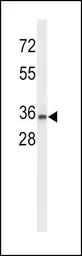 Anti-UPK1A antibody, C-term used in Western Blot (WB). GTX80479