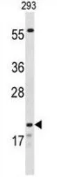 Anti-Claudin 8 antibody, Internal used in Western Blot (WB). GTX80481