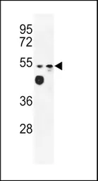 Anti-MARVELD2 antibody, C-term used in Western Blot (WB). GTX80484