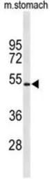 Anti-Kir6.2 antibody, N-term used in Western Blot (WB). GTX80493