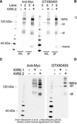 Anti-Kir6.2 antibody, N-term used in Western Blot (WB). GTX80493