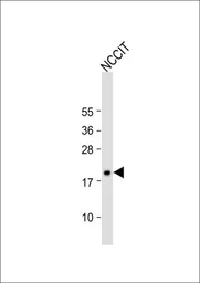 Anti-HMGA1 antibody, C-term used in Western Blot (WB). GTX80558