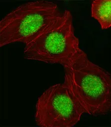 Anti-HMGA1 antibody, C-term used in Immunocytochemistry/ Immunofluorescence (ICC/IF). GTX80558