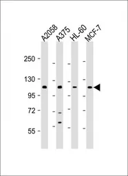 Anti-COL17A1 antibody, Internal used in Western Blot (WB). GTX80563