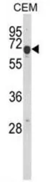 Anti-EDIL3 antibody, Internal used in Western Blot (WB). GTX80621