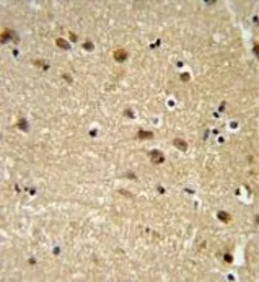 Anti-EDIL3 antibody, Internal used in IHC (Paraffin sections) (IHC-P). GTX80621