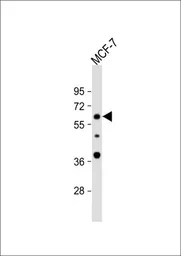 Anti-APEX2 antibody, Internal used in Western Blot (WB). GTX80642
