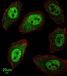 Anti-APEX2 antibody, Internal used in Immunocytochemistry/ Immunofluorescence (ICC/IF). GTX80642