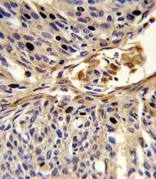 Anti-APEX2 antibody, Internal used in IHC (Paraffin sections) (IHC-P). GTX80642