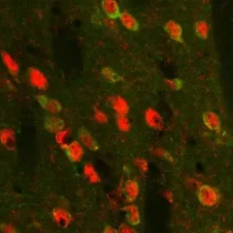 Anti-Proenkephalin antibody used in Immunohistochemistry (IHC). GTX80743