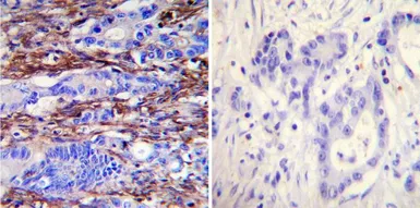 Anti-Actin antibody [mAbGEa] used in IHC (Paraffin sections) (IHC-P). GTX80809