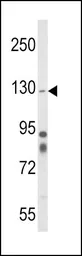 Anti-Integrin alpha 1 antibody, Internal used in Western Blot (WB). GTX81008