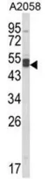 Anti-AGPAT3 antibody, Internal used in Western Blot (WB). GTX81092