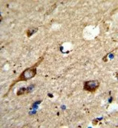 Anti-AGPAT3 antibody, Internal used in IHC (Paraffin sections) (IHC-P). GTX81092