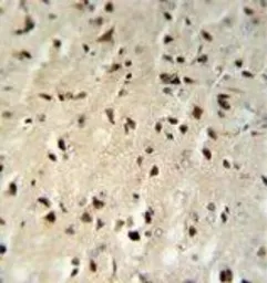 Anti-FKBP1B antibody, N-term used in IHC (Paraffin sections) (IHC-P). GTX81257