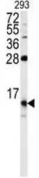 Anti-FKBP1B antibody, N-term used in Western Blot (WB). GTX81257