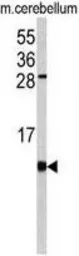 Anti-FKBP1B antibody, N-term used in Western Blot (WB). GTX81257