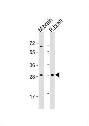 Anti-Rho 8 antibody, Internal used in Western Blot (WB). GTX81316
