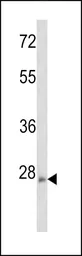 Anti-Rho 8 antibody, Internal used in Western Blot (WB). GTX81316