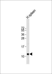 Anti-NAP2 antibody, N-term used in Western Blot (WB). GTX81397