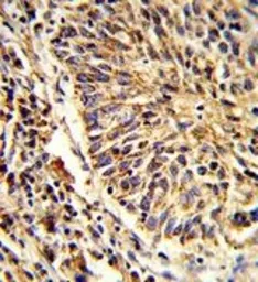 Anti-ADAM9 antibody, C-term used in IHC (Paraffin sections) (IHC-P). GTX81448