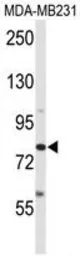 Anti-ADAM9 antibody, C-term used in Western Blot (WB). GTX81448
