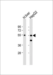 Anti-CPN1 antibody, N-term used in Western Blot (WB). GTX81518