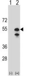 Anti-CPN1 antibody, N-term used in Western Blot (WB). GTX81518