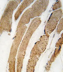Anti-PDK4 antibody, Internal used in IHC (Paraffin sections) (IHC-P). GTX81596