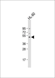 Anti-PDK4 antibody, Internal used in Western Blot (WB). GTX81596