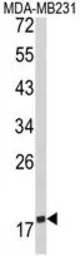 Anti-CD28 antibody, C-term used in Western Blot (WB). GTX81608