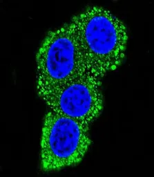 Anti-CD28 antibody, C-term used in Immunocytochemistry/ Immunofluorescence (ICC/IF). GTX81608